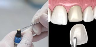 فرق کامپوزیت و لمینت فرق کامپوزیت و لمینت