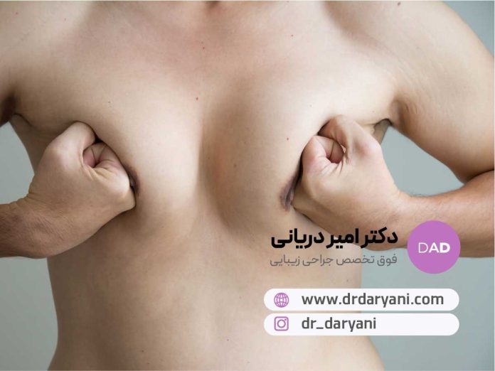 جراحی ژنیکوماستی، راهی مطمئن برای بازگشت سینه‌ها به فرم طبیعی